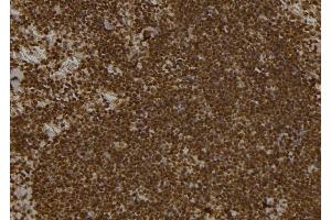 ABIN6261807 and ABIN6277494 at 1/100 staining Mouse spleen tissue by IHC-P. (FOXP1 anticorps  (C-Term))