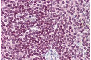 Human Spleen: Formalin-Fixed, Paraffin-Embedded (FFPE)