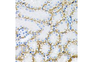 Immunohistochemistry of paraffin-embedded mouse kidney using MAPT antibody (ABIN5970456) at dilution of 1/100 (40x lens). (MAPT anticorps)