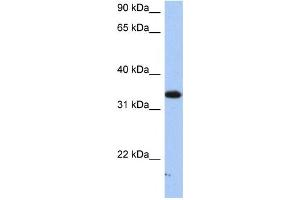 SULT6B1 anticorps