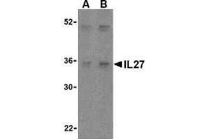Western blot analysis of IL-27 in Daudi lysate with AP30421PU-N IL-27 antibody at (A) 2 and (B) 4 μg/ml. (IL27 anticorps  (Center))