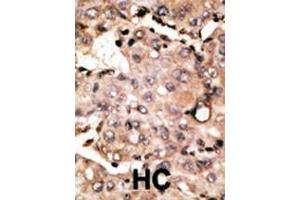 anti-Autophagy related 4D Cysteine Peptidase (ATG4D) (AA 441-470), (C-Term) antibody