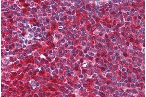 Human Tonsil (formalin-fixed, paraffin-embedded) stained with PYCARD antibody ABIN213971 at 5 ug/ml followed by biotinylated goat anti-rabbit IgG secondary antibody ABIN481713, alkaline phosphatase-streptavidin and chromogen. (PYCARD anticorps  (AA 182-195))