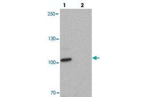 Western blot analysis of CCNT1 in rat brain tissue with CCNT1 polyclonal antibody  at 1 ug/mL in (lane 1) the absence and (lane 2) the presence of blocking peptide. (Cyclin T1 anticorps  (C-Term))