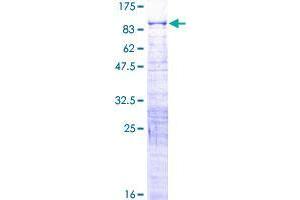 Image no. 1 for Glioma Tumor Suppressor Candidate Region Gene 2 (GLTSCR2) (AA 1-478) protein (GST tag) (ABIN1355256)