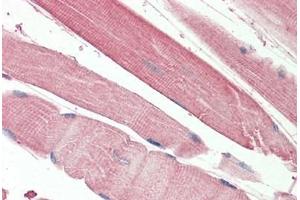 Human Skeletal Muscle: Formalin-Fixed, Paraffin-Embedded (FFPE) (THNSL2 anticorps  (AA 192-204))