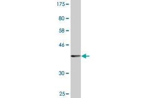 Western Blot detection against Immunogen (37.