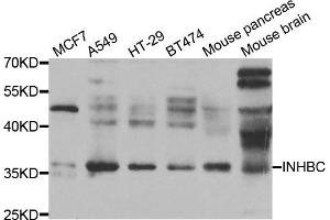Western blot analysis of extracts of various cell lines, using INHBC antibody. (INHBC anticorps)