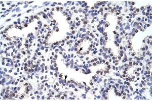 Rabbit Anti-WNT2B Antibody Catalog Number: ARP41254 Paraffin Embedded Tissue: Human Lung Cellular Data: Alveolar cells Antibody Concentration: 4. (WNT2B anticorps  (Middle Region))