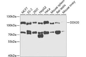 Western blot analysis of extracts of various cell lines, using DDX20 antibody (ABIN6130250, ABIN6139482, ABIN6139483 and ABIN6221507) at 1:1000 dilution. (DDX20 anticorps  (AA 25-280))