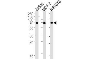 Western Blotting (WB) image for anti-Ribosomal Protein S6 Kinase, 70kDa, Polypeptide 2 (RPS6KB2) antibody (ABIN2995324) (RPS6KB2 anticorps)