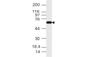 Image no. 1 for anti-Cytochrome P450, Family 1, Subfamily B, Polypeptide 1 (CYP1B1) (AA 1-260) antibody (ABIN5027128) (CYP1B1 anticorps  (AA 1-260))