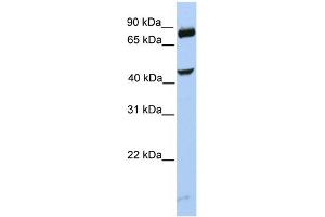 WB Suggested Anti-SMYD3 Antibody Titration:  0. (SMYD3 anticorps  (C-Term))