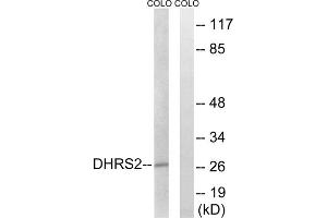 Western blot analysis of extracts from COLO cells, using DHRS2 antibody. (DHRS2 anticorps  (Internal Region))