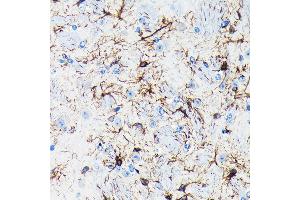 Immunohistochemistry of paraffin-embedded mouse brain using GFAP Rabbit mAb (ABIN7267389) at dilution of 1:100 (40x lens). (GFAP anticorps)