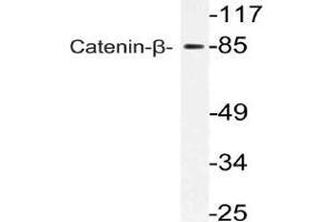 Western blot (WB) analysis of Catenin-beta antibody in extracts from 293 cells. (CTNNB1 anticorps)