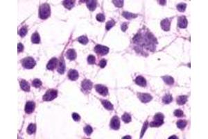 Anti-GRM3 / MGLUR3 antibody immunocytochemistry (ICC) staining of untransfected HEK293 human embryonic kidney cells.