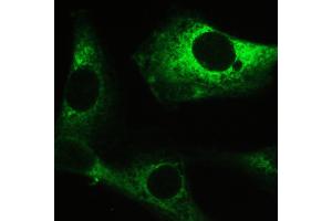 IHC analysis of PPP1R12A using anti-PPP1R12A antibody . (PPP1R12A anticorps  (N-Term))