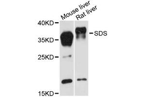 Western blot analysis of extracts of various cell lines, using SDS antibody (ABIN6293759) at 1:3000 dilution. (serine Dehydratase anticorps)