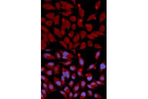 Immunofluorescence analysis of U2OS cell using DNMT3A antibody. (DNMT3A anticorps  (AA 500-700))
