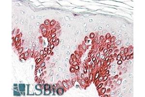 ABIN625834 (3. (SIRT1 anticorps  (AA 577-590))