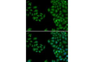 Immunofluorescence (IF) image for anti-Neurofilament, Light Polypeptide (NEFL) (AA 400-543) antibody (ABIN6213733) (NEFL anticorps  (AA 400-543))
