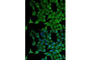 Immunofluorescence analysis of HeLa cell using KRT20 antibody. (KRT20 anticorps  (AA 245-424))