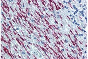 Human Brain, Cerebellum: Formalin-Fixed, Paraffin-Embedded (FFPE) (Spastin anticorps  (AA 200-305))