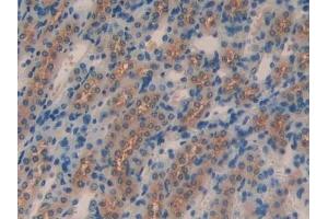 Detection of KLb in Mouse Kidney Tissue using Polyclonal Antibody to Klotho Beta (KLb)