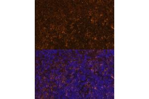 Immunofluorescence analysis of mouse spleen using KLRC4 Polyclonal Antibody (ABIN7268115) at dilution of 1:100 (40x lens).