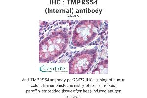 Image no. 2 for anti-Transmembrane Protease, serine 4 (TMPRSS4) (Internal Region) antibody (ABIN1740176) (TMPRSS4 anticorps  (Internal Region))
