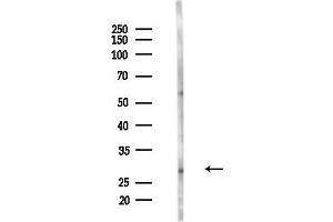 anti-Melanoma Antigen Family A, 8 (MAGEA8) (C-Term) antibody
