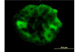 Immunofluorescence of monoclonal antibody to SHC1 on A-431 cell.