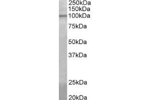 Western Blotting (WB) image for anti-ATP/GTP Binding Protein-Like 5 (AGBL5) (AA 137-149) antibody (ABIN1099865) (AGBL5 anticorps  (AA 137-149))