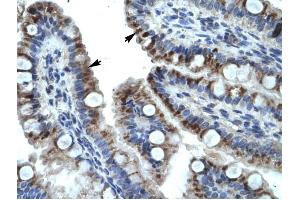 KRT15 antibody was used for immunohistochemistry at a concentration of 4-8 ug/ml to stain Epithelial cells of intestinal villus (arrows) in Human Intestine.