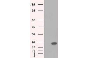 HEK293T cells were transfected with the pCMV6-ENTRY control (Left lane) or pCMV6-ENTRY BDH2 (Right lane) cDNA for 48 hrs and lysed.