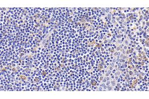 Detection of Bcl2 in Human Amygdalitis Tissue using Monoclonal Antibody to B-Cell Leukemia/Lymphoma 2 (Bcl2) (Bcl-2 anticorps  (AA 2-211))