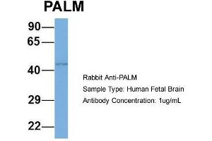 Host: Rabbit  Target Name: PALM  Sample Tissue: Human Fetal Brain  Antibody Dilution: 1. (Paralemmin anticorps  (N-Term))