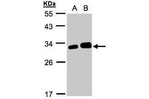 WB Image Sample(30 ug whole cell lysate) A:293T B:HeLa S3, 12% SDS PAGE antibody diluted at 1:1000 (Latexin anticorps)