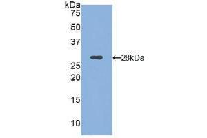 Western blot analysis of recombinant Mouse ITGaD. (ITGAD anticorps  (AA 886-1106))