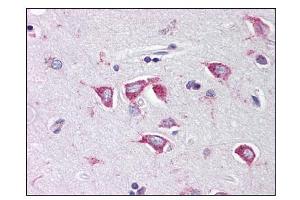 Image no. 1 for anti-Poly(rC) Binding Protein 4 (PCBP4) (C-Term) antibody (ABIN303232)
