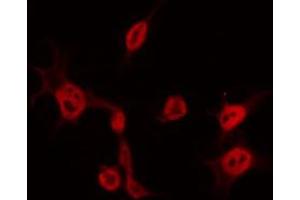 ABIN6267580 staining COS7 by IF/ICC. (CDK5 anticorps  (pTyr15))