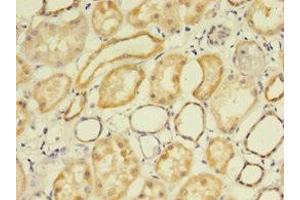 Immunohistochemistry of paraffin-embedded human kidney tissue using ABIN7158118 at dilution of 1:100 (FLRT1 anticorps  (AA 21-289))