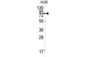 Western blot analysis of CD31 antibody (C-term) in HL60 cell line lysates (35ug/lane).