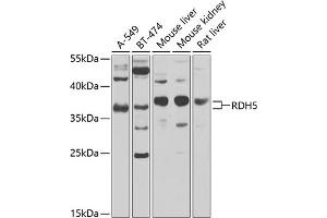 Western blot analysis of extracts of various cell lines, using RDH5 antibody (ABIN6130851, ABIN6146839, ABIN6146840 and ABIN6224076) at 1:1000 dilution.