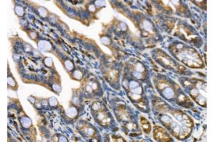 ABIN6264961 and ABIN6279698 at 1/100 staining Mouse colorectal tissue by IHC-P. (SEC61B anticorps  (N-Term))