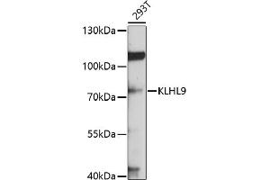 Western blot analysis of extracts of 293T cells, using KLHL9 antibody (ABIN6132083, ABIN6142940, ABIN6142941 and ABIN6214299) at 1:1000 dilution. (KLHL9 anticorps  (AA 1-100))