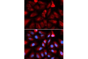 Immunofluorescence analysis of U2OS cells using FKBP4 antibody (ABIN5973289). (FKBP4 anticorps)