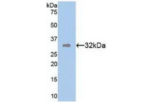Detection of Recombinant TR1, Human using Polyclonal Antibody to Tomoregulin 1 (TR1)