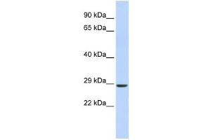 Western Blotting (WB) image for anti-SIX Homeobox 2 (SIX2) antibody (ABIN2458374)